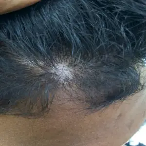 Before image