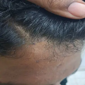 After image