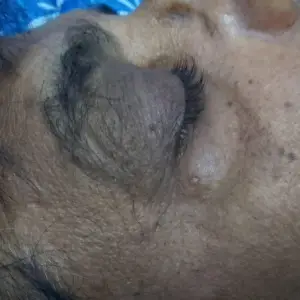 After image