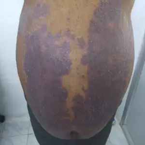 After image