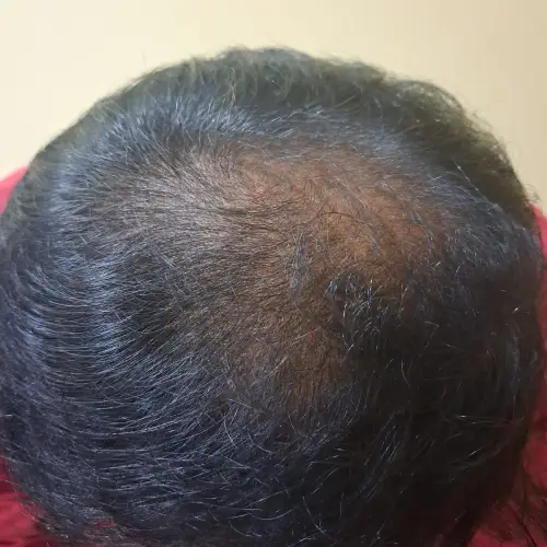 After image