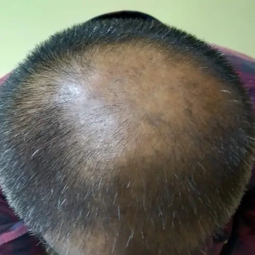 Before image